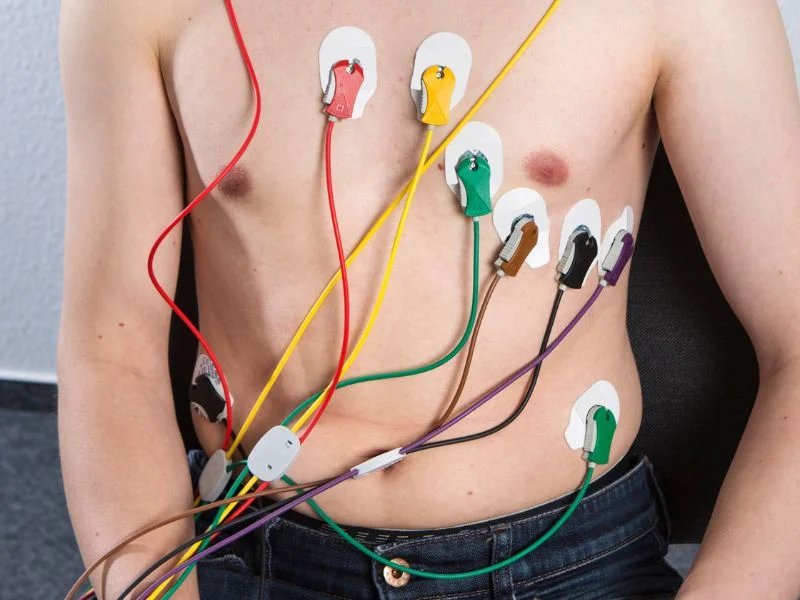 mantenimiento electrocardiografo