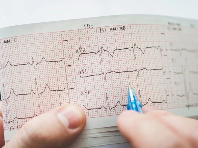 electrocardiógrafo portátil de 12 derivaciones