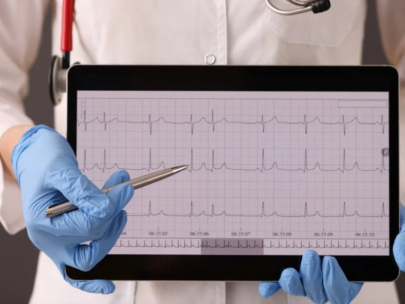 Electrocardiógrafo digital 2 Electrocardiógrafo digital